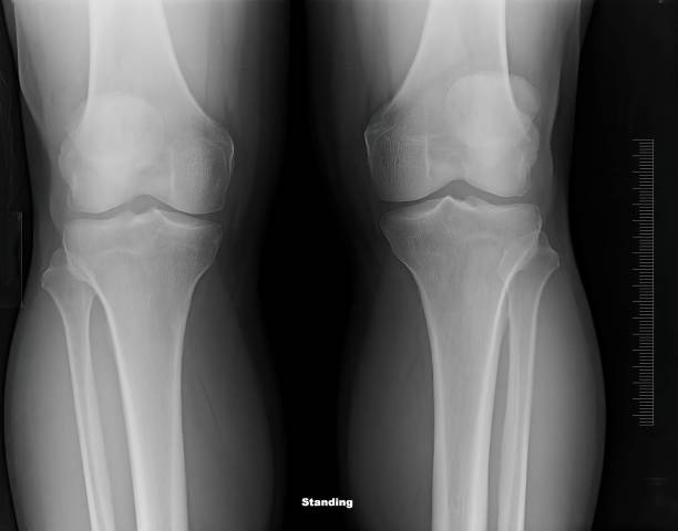 Joint and bone health